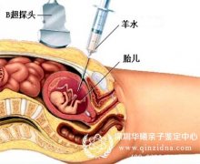 羊水穿刺可以做亲子鉴定吗